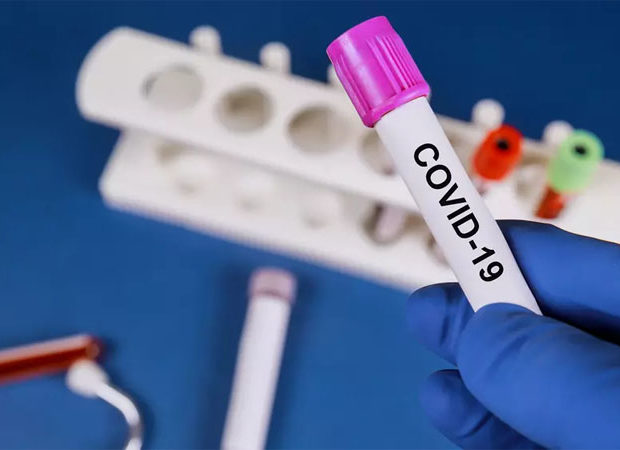 Azərbaycanda son sutkada 24 nəfər koronavirusa yoluxub, 3 nəfər ölüb