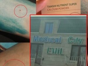 Xəstə uşaq üzərində eksperement – “Medical City Emil” klinikasının həkimi 275 manatlıq dərmanlar……